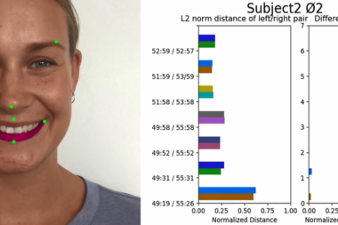 Quantifying Asymmetrical Face (Quant-A-Face)