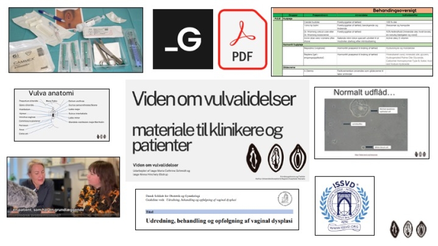 Viden om Vulvalidelser: Forbedret og omkostningseffektiv indsats for kvinder med vulvalidelser